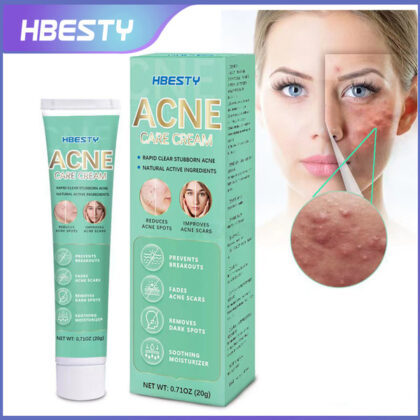 Hbesty Acne Care Cream